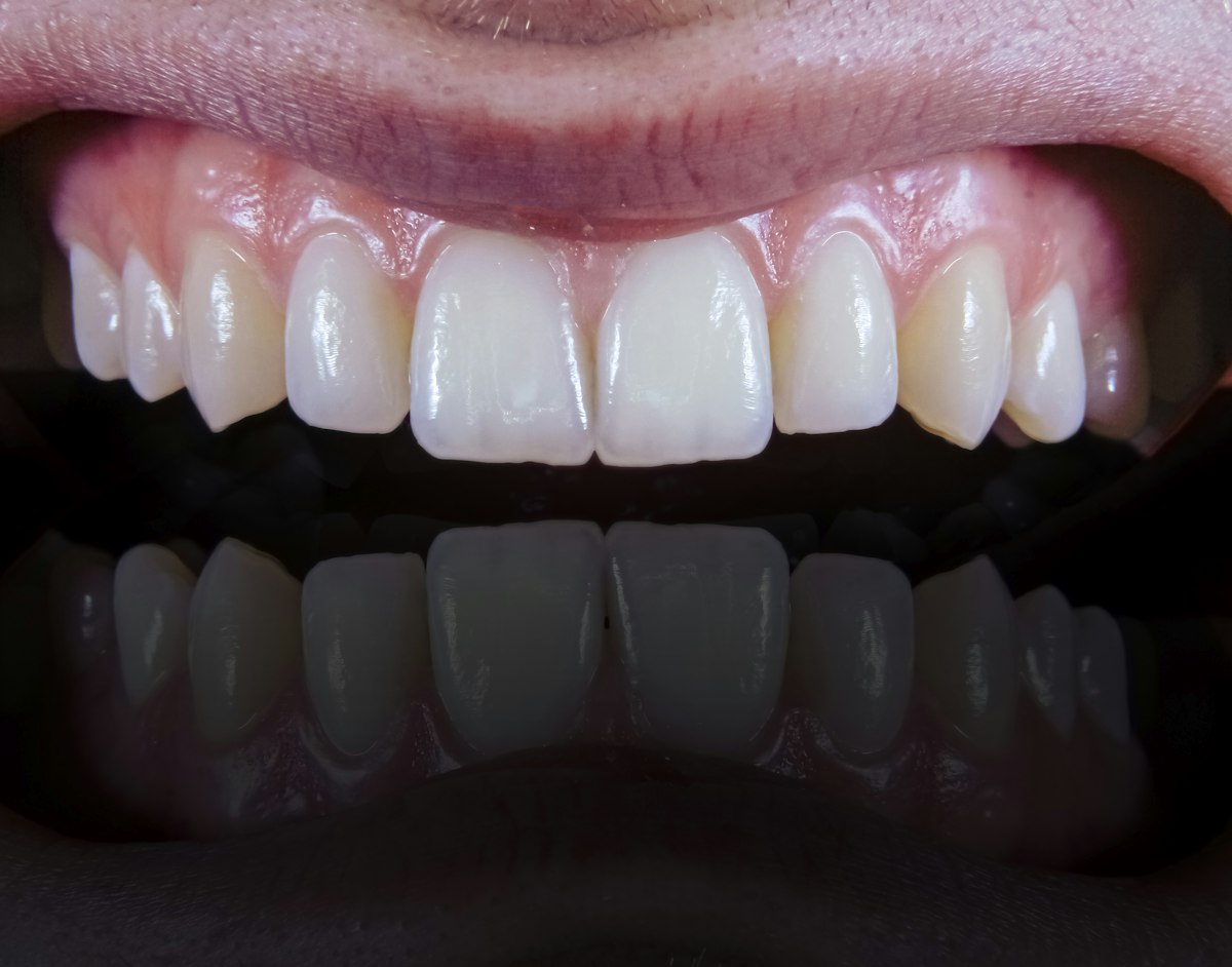 Immagine dimostrativa: situazione iniziale