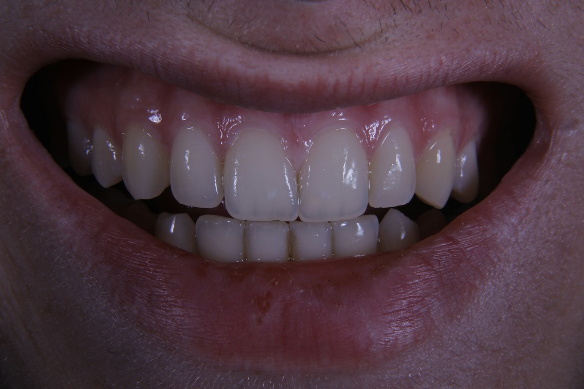 Immagine dimostrativa: risultato